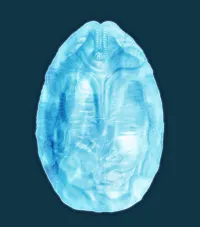 KOTOBUKIYA Silicone Tray - Alien Egg - Alien (Movie Franchise) - photo 4